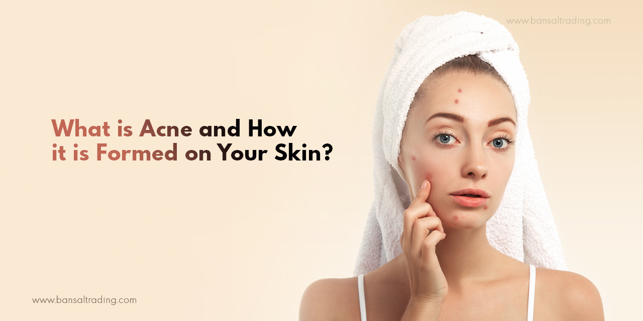 skincare routine for acne-prone skin